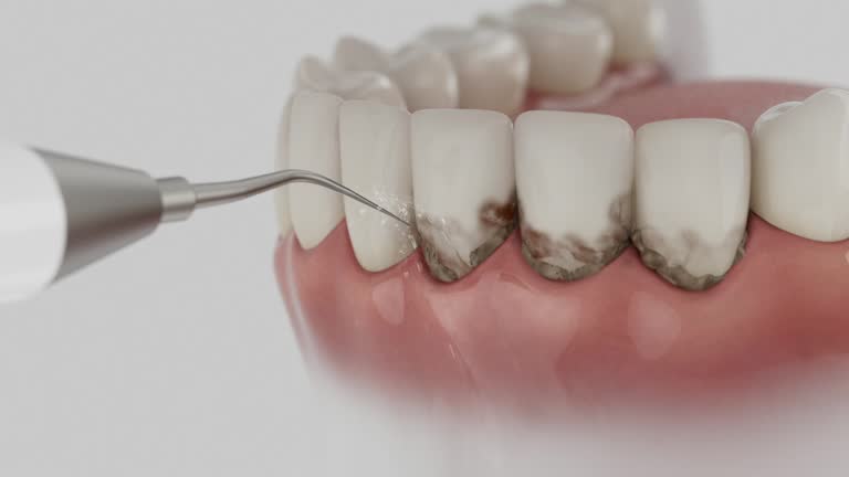 Trusted Emergency Dentist service in Cumberland, KY - Dentist Open Now